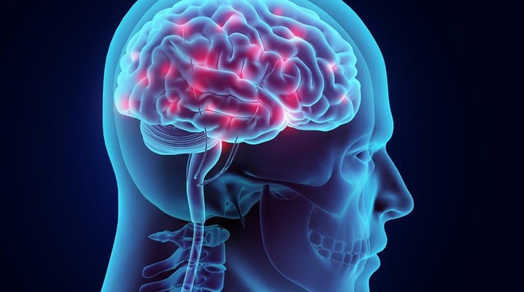 Challenges to the implementation of stroke thrombolysis