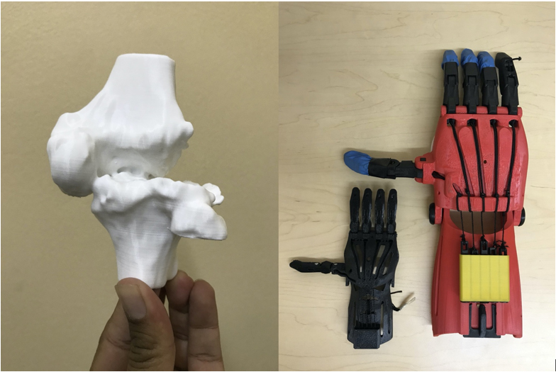 3D Printing in Orthopaedics Viewpoint Article